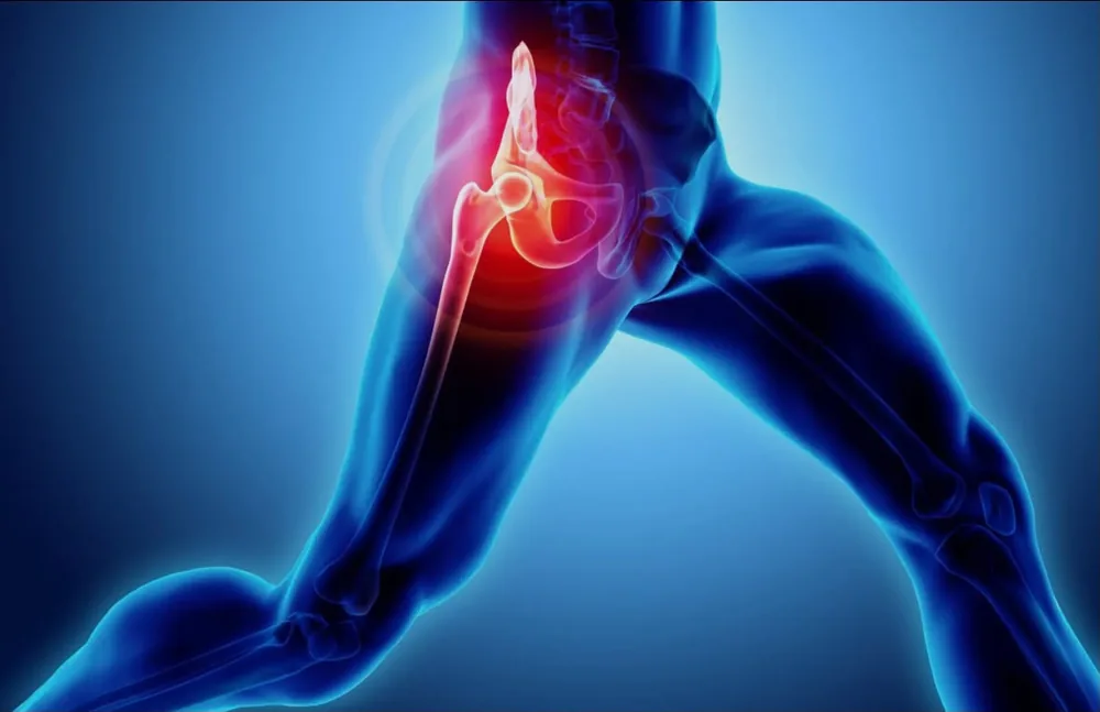 Illustrazione dell'articolazione dell'anca con evidenza del dolore